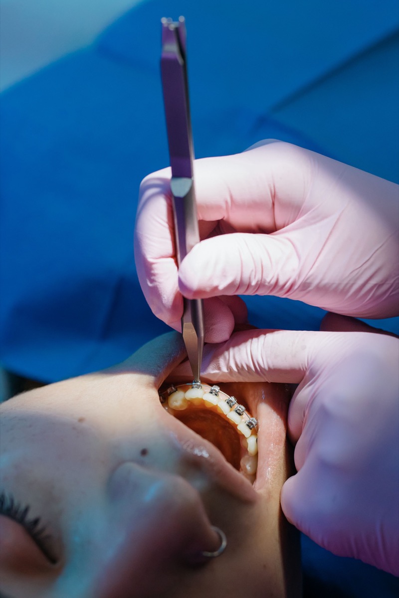 Illustrative view of gloved hands adjusting braces